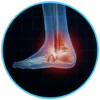 foot